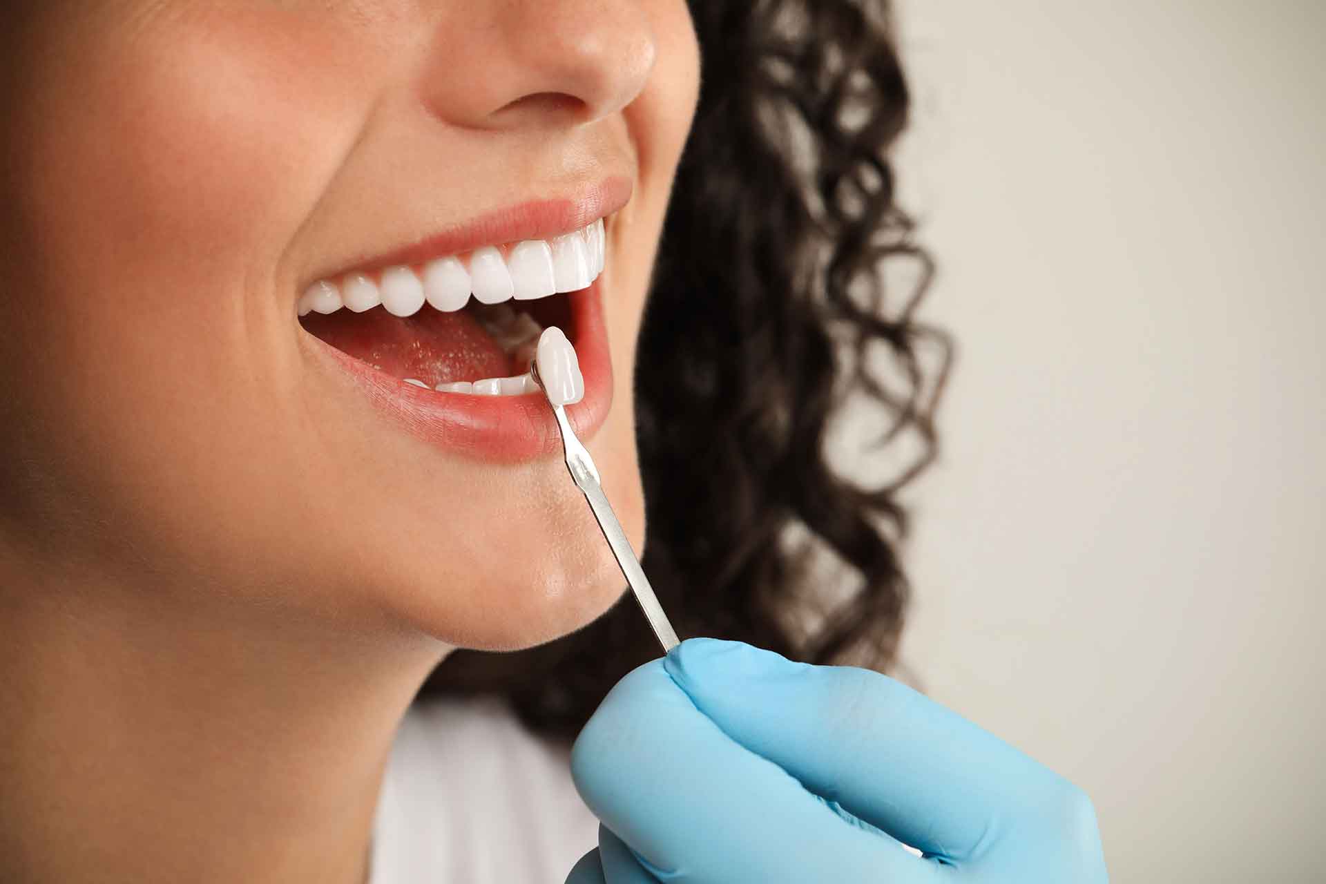 Veneers und Kronen bei Zahnfleischrückgang